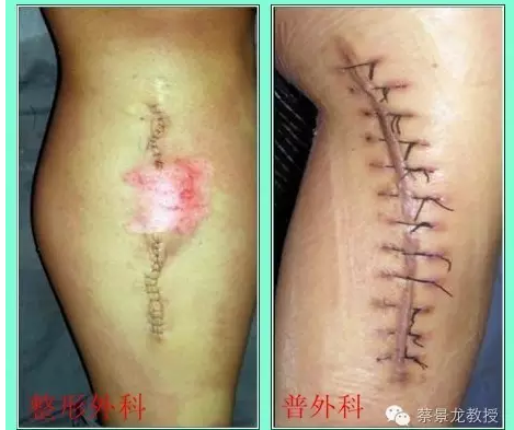 美容缝合，给你最温柔的爱