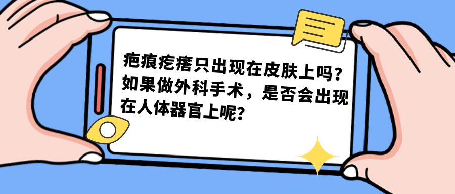 【蔡景龙教授瘢痕治疗科普】疤痕疙瘩只出现在皮肤上吗？如果做外科手术，是否会出现在人体器官上呢？